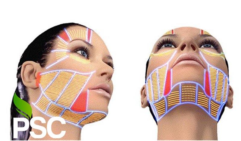 کارگاه هایفوتراپی یا هایفو تراپی HIFU