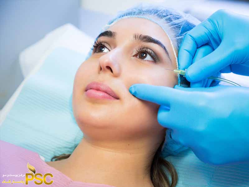 دربارۀ این مقاله بیشتر بخوانید خدمات کربوکسی تراپی