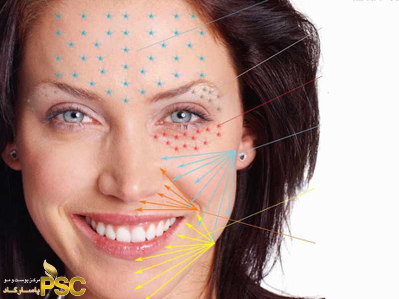 دربارۀ این مقاله بیشتر بخوانید خدمات پلاسما تراپی