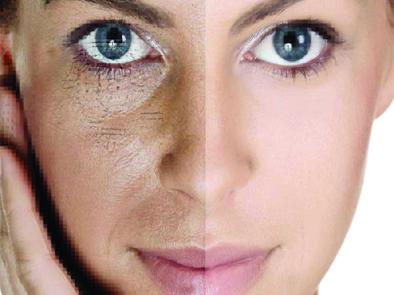 Read more about the article What to do with open pores? It means orange peel skin