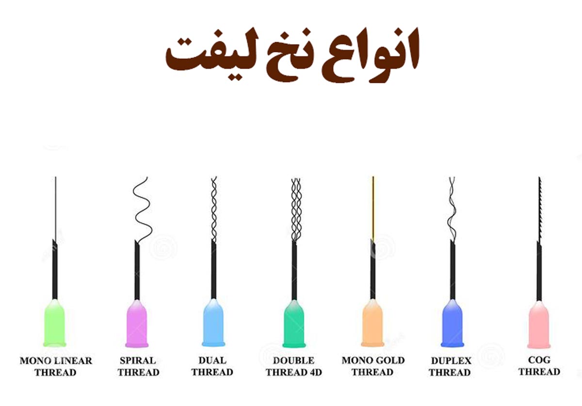 همه چیز در مورد لیفت با نخ؛ انواع، کاربردها و معایب